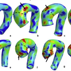 Cardiac Biomechanics Lab Site